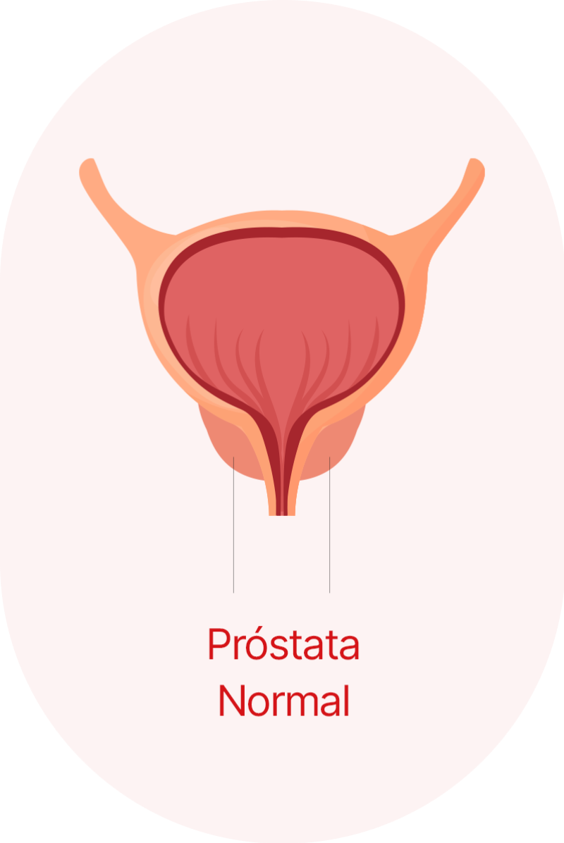 Próstata Normal 